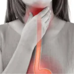 Rimedi naturali contro il mal di gola