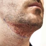 chirurgia plastica maschile