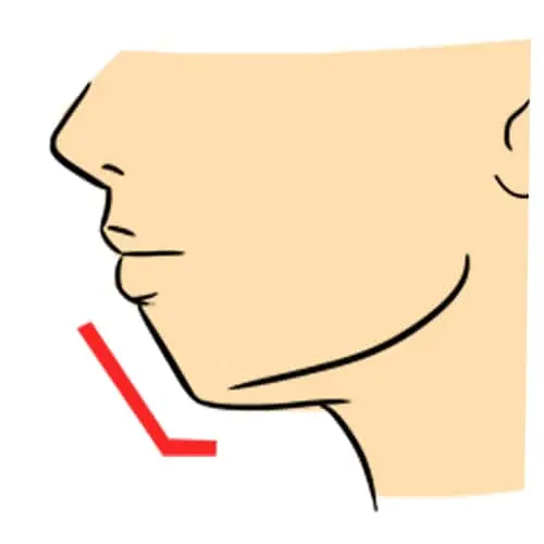 Il mento piccolo in un uomo, considerazioni e trattamenti mento piccolo uomo