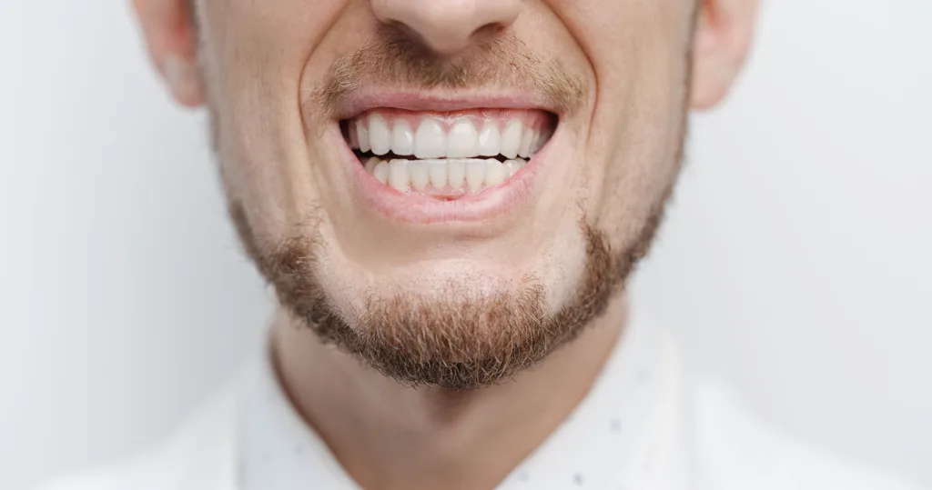 bruxismo negli uomini