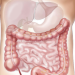 Notizie delle ultime ore, non ufficiali, diffondono la voce che l'intervento a cui si è sottoposta Kate Middleton, la Duchessa di Cambridge, sia stato un intervento di ileostomia