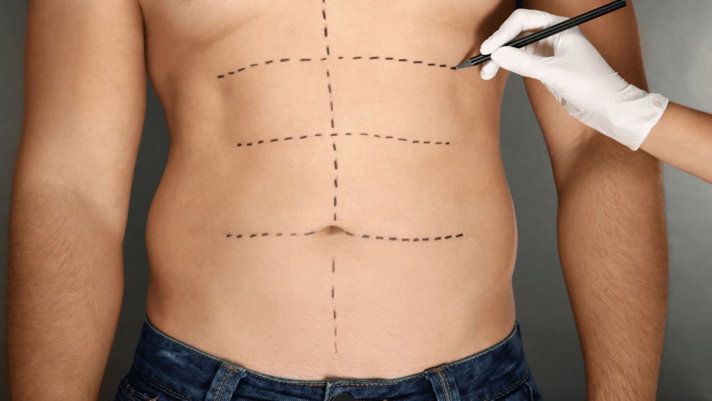 Negli ultimi anni, il fenomeno della chirurgia estetica ha visto un significativo aumento tra gli uomini. Se un tempo questo settore era prevalentemente dominato dalle donne, oggi sempre più uomini decidono di sottoporsi a interventi estetici per migliorare il proprio aspetto