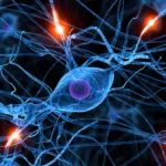 dbs parkinson san camillo